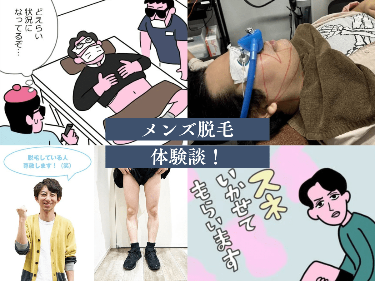 【メンズヒゲ医療脱毛行ってみた】モデル豊田、編集長、エディターの体験ルポ5選！脱毛初心者向けの「痛い？」「何回行くの？」などQ&Aまで