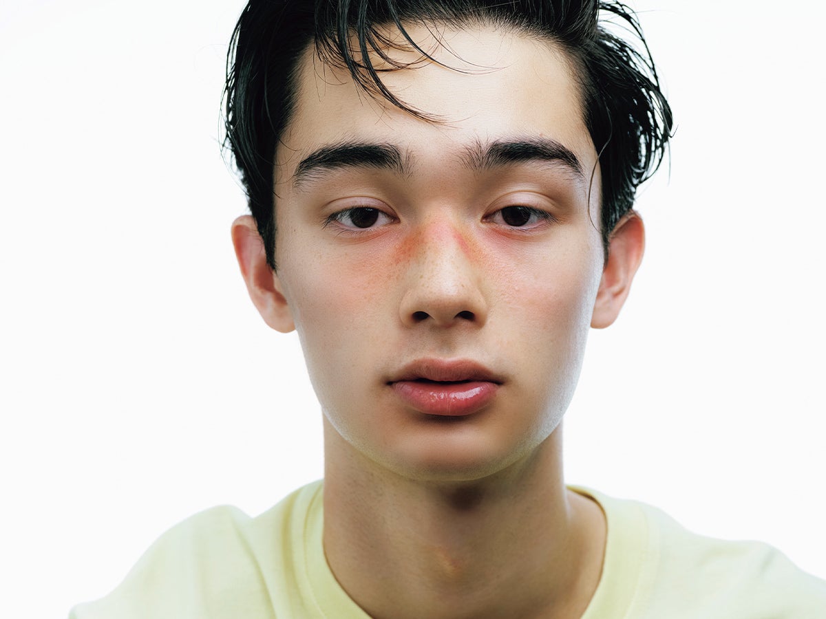 日焼けをしたらアフターケアは何をすべき？ひんやりうるおす夏の“レスキューコスメ”