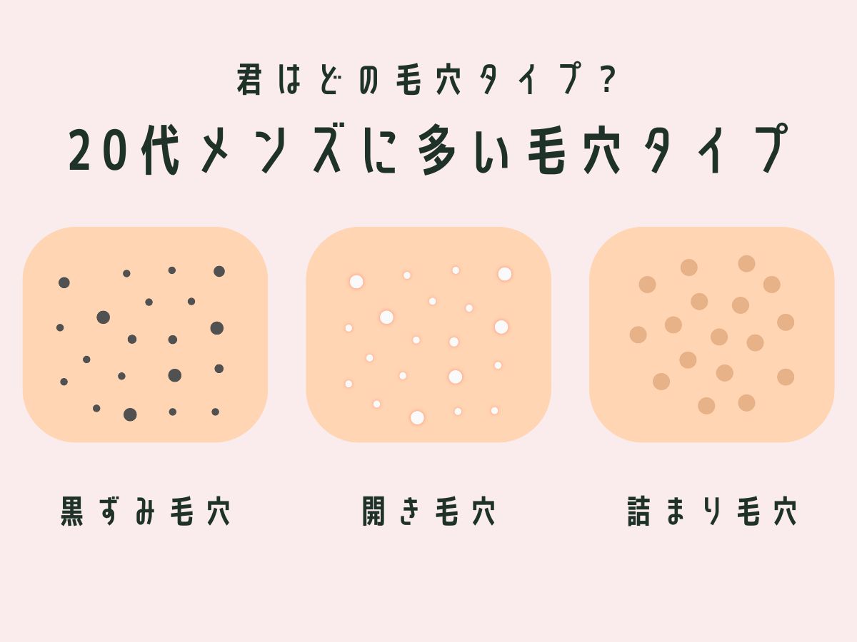 20代のメンズ(男)に多い毛穴のお悩みタイプの図
