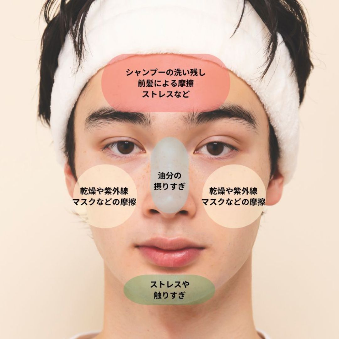 部位別で見る肌荒れの原因