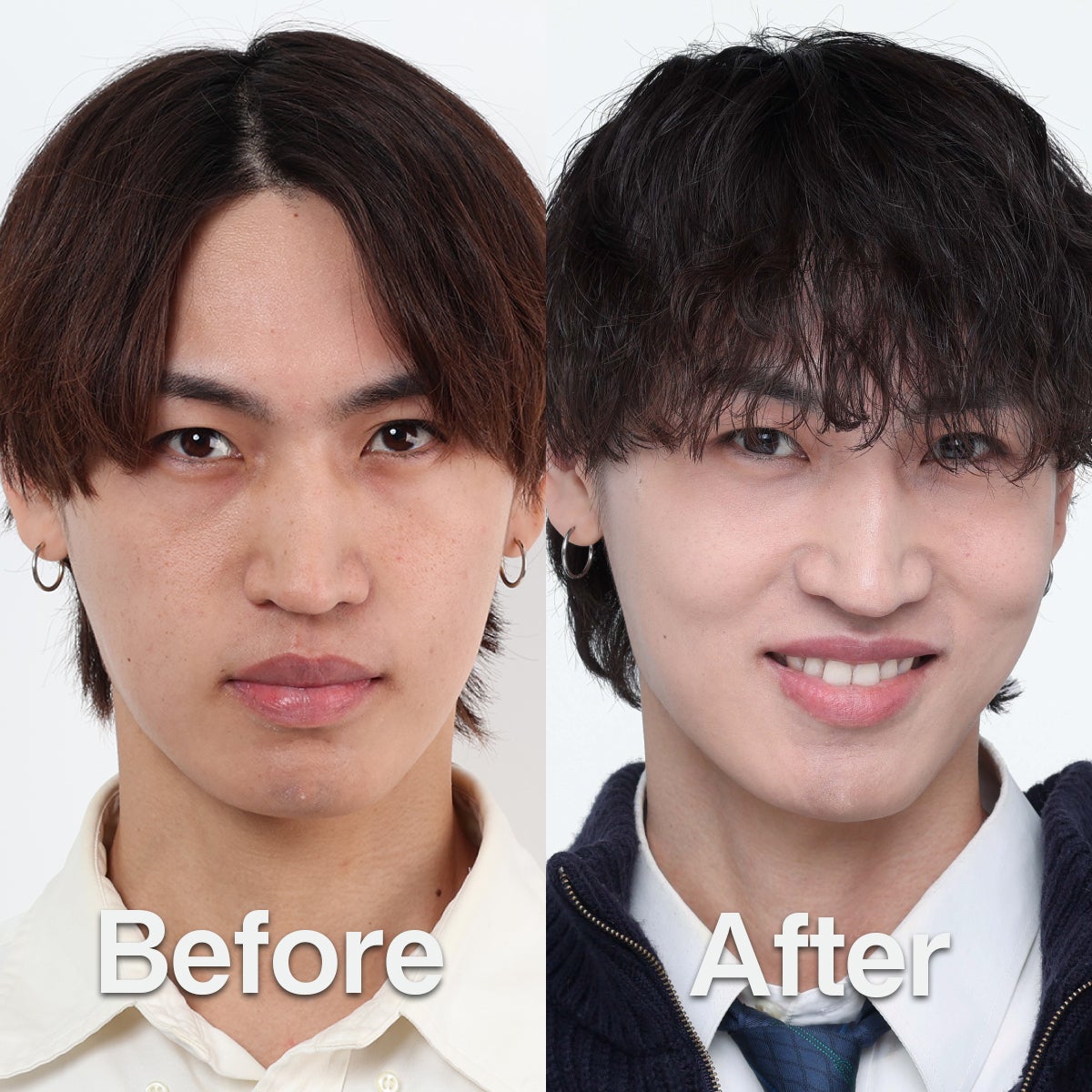 メンズスキンケアブランドDISM　渡辺龍星さんのビフォー・アフター