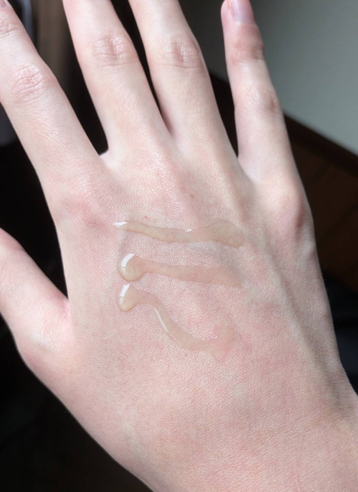 アゼライン酸15 インテンスカーミングセラム テクスチャー