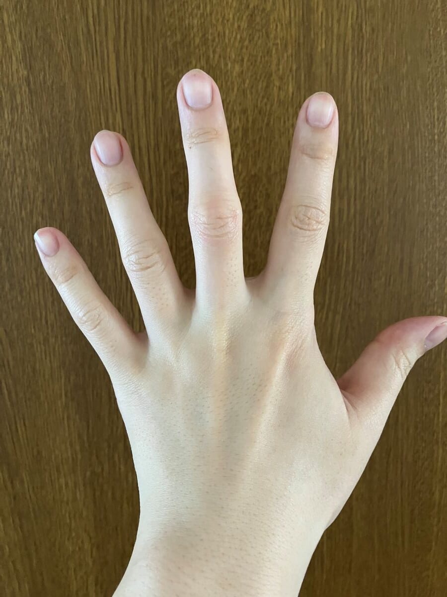 洗い流した後の画像